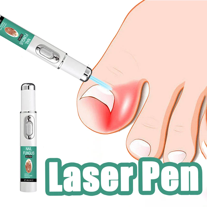 

Laser pen, protect the health of your nails.