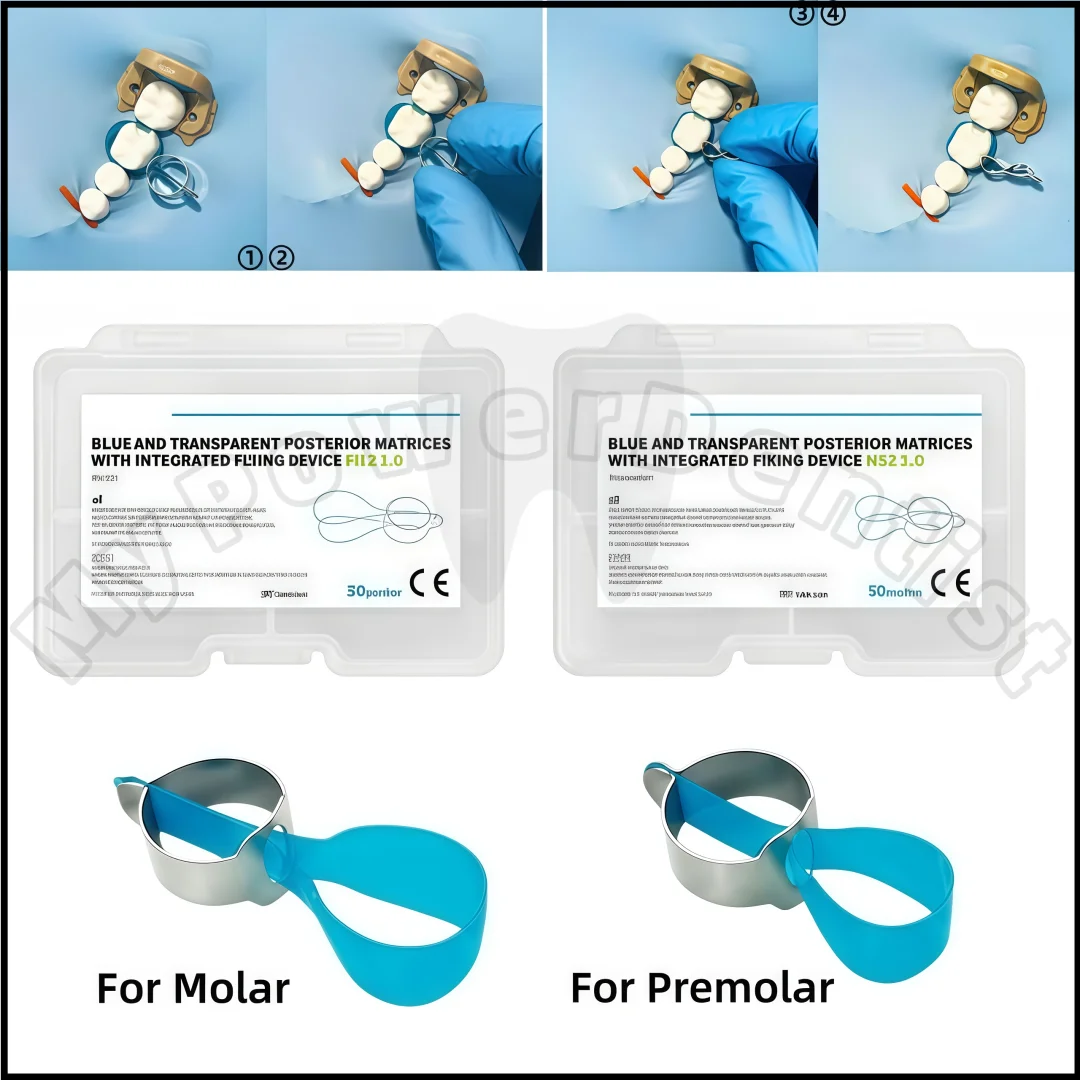 50Pcs Posterior Blue Matrices Fixing Device Dental Matrix Bands Molar/Premoar Strips