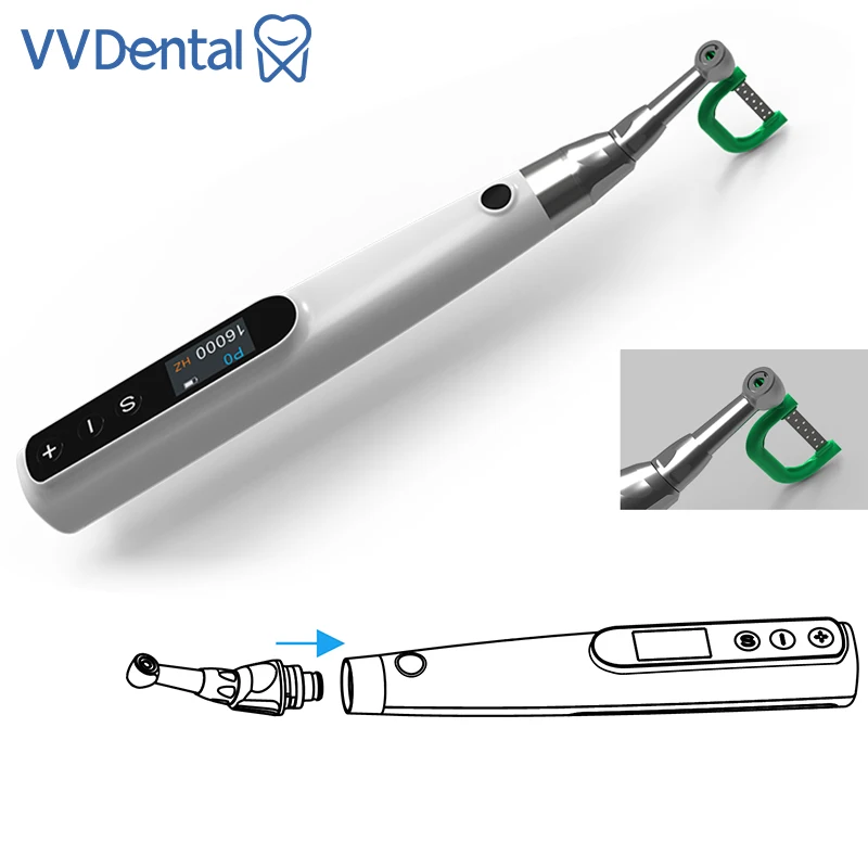 

Ортодонтический профилактический моторный наконечник Поршневая межпроксимальная зачистка IPR Finer Стоматологическая электрическая беспроводная система IPR