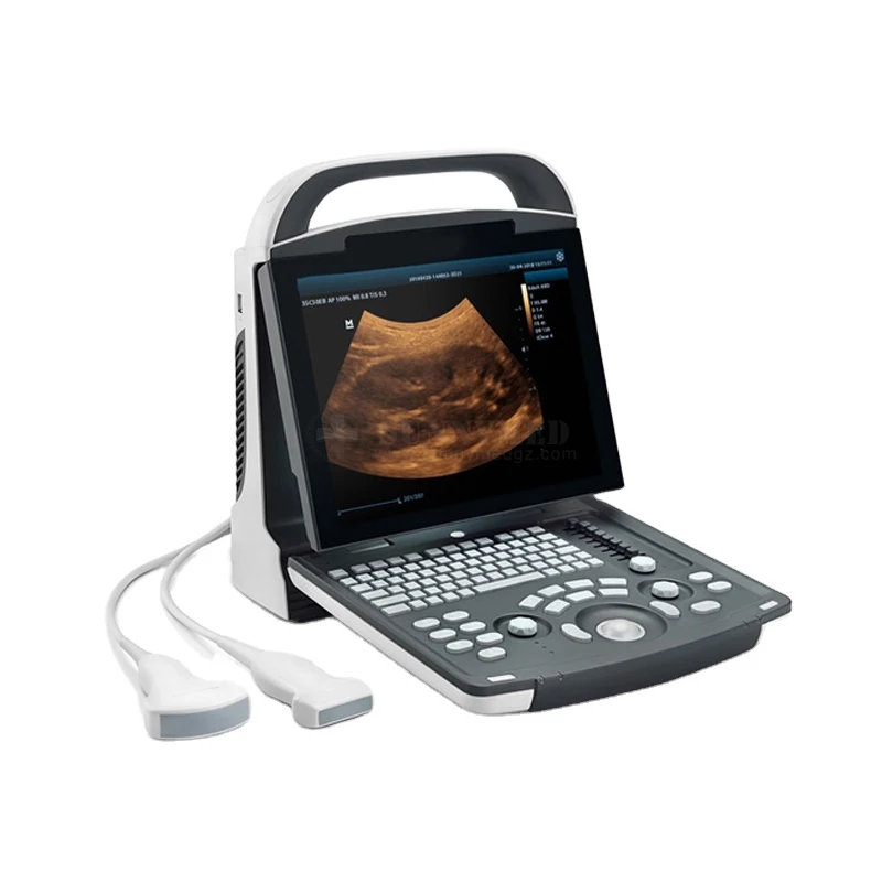 

Ecografo black and white ultrasound machine Mindray DP-10 with convex probe for human use dp-10