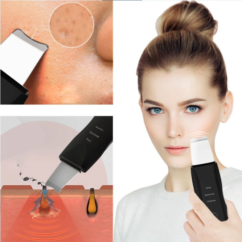 Ultrasonic Skin Scrub Skin Scraper Pore Cleanser Exfoliating Cleanser Black Head Exfoliating Essence Face Scrubber Lift Machine