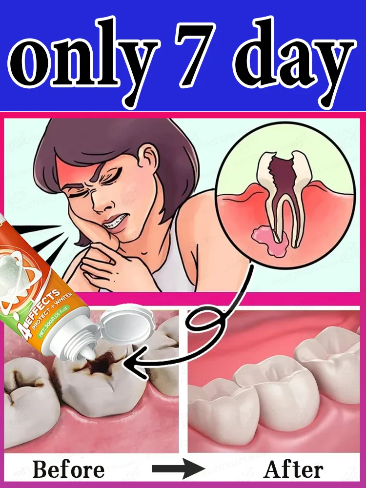 

Sᴄɪᴇɴᴛɪғɪᴄ Rᴇᴘᴀɪʀs Cᴀᴠɪᴛɪᴇs, Cʟᴇᴀɴs Pʟᴀᴏ̨ᴜᴇ, Wʜɪᴛᴇɴs Tᴇᴇᴛʜ