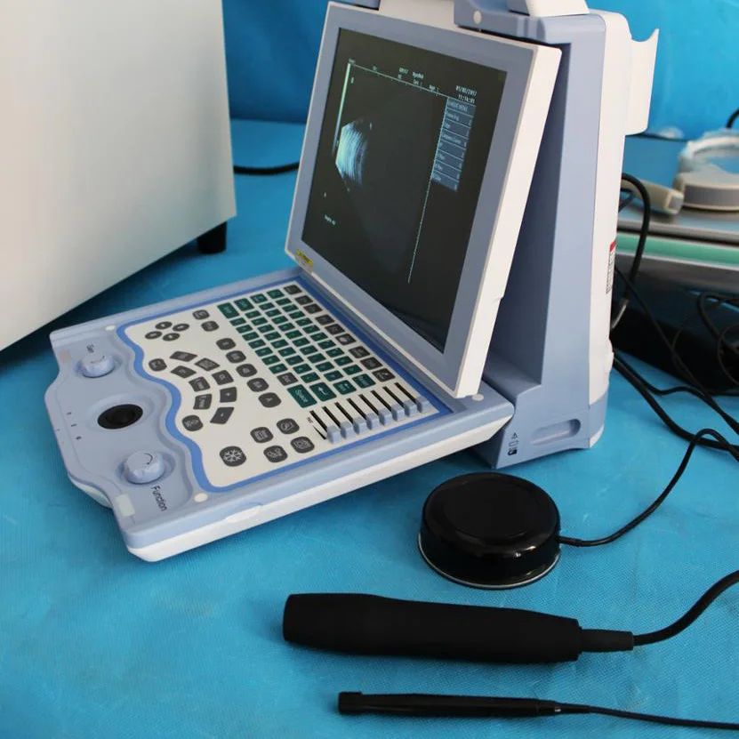 10.4 inch High Resolution LCD Screen Ophthalmic Ultrasound A/B Scan Machine Eye Ultrasound for Ophthalmolog