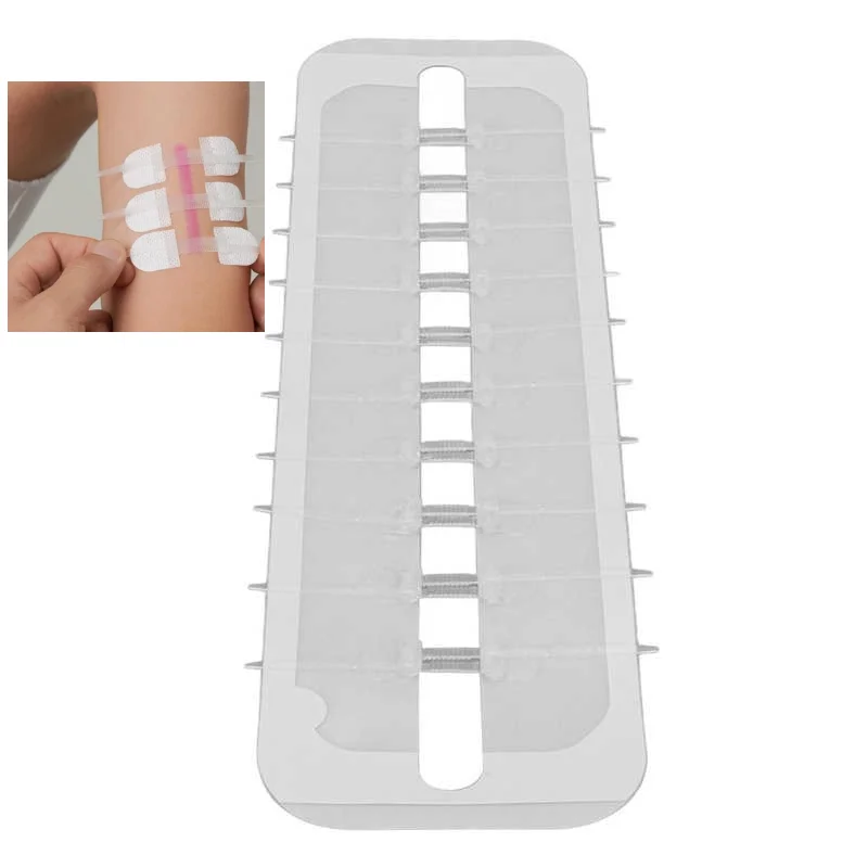 

Zipper Tie Band Aid Adhesive Wound Closure Band Aid Wound Closure Bandaid Emergency Kit Bandage Fast Suture Hemostatic Patch New