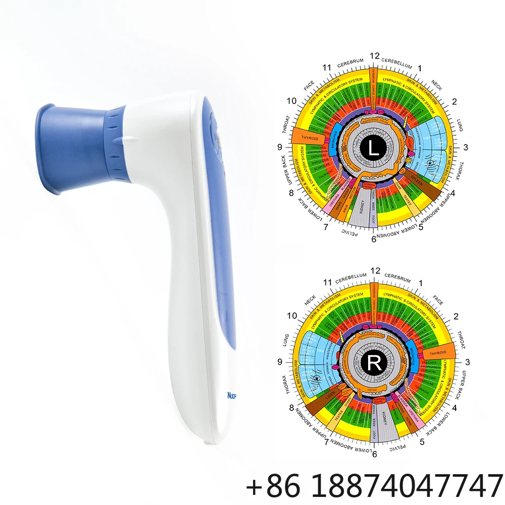 Best Factory Price Body Health Iridology  Analysis USB Eye Iris Scanner Digital Iriscope with Iridology Kamera-software