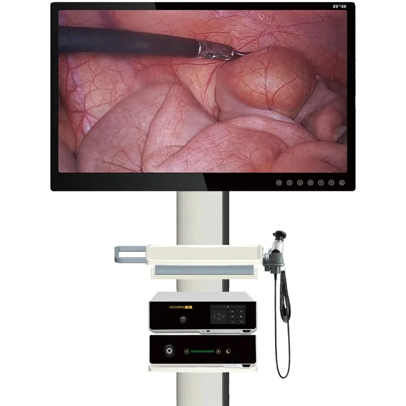 4K Medical Ultra High Definition endoscope Head UHD Telescope With Endoscope LED Light Source