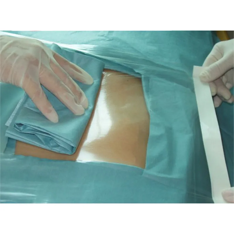 : Medical Dressings