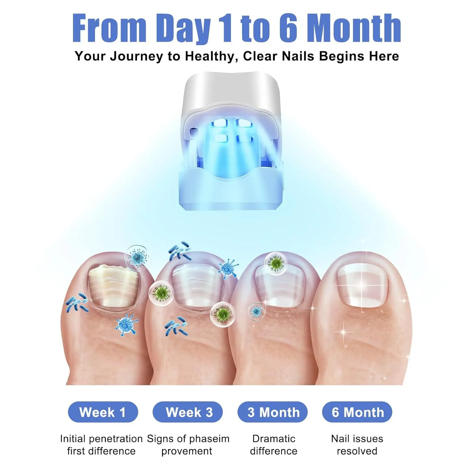 Nail Fungus 905nm Infrared Light 470nm Blue Light Onychomycosis Nail Fungus Cleaning Light Device USB Charge NailSalon