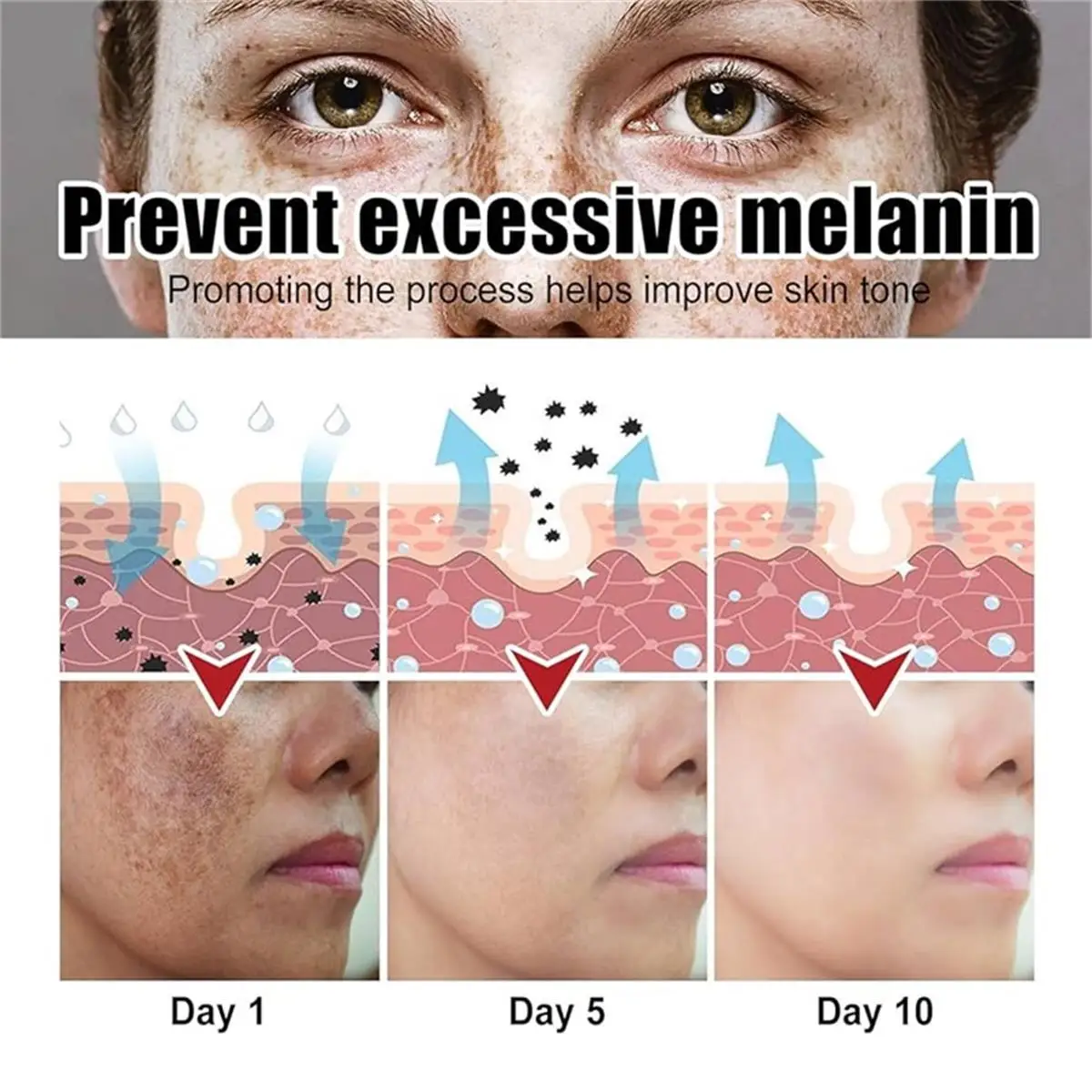Whitening Freckles Face Cream Removal Melasma Dark Spots Corrector Lighten Melanin Pigmentation Brighten Anti-Aging Beauty Care
