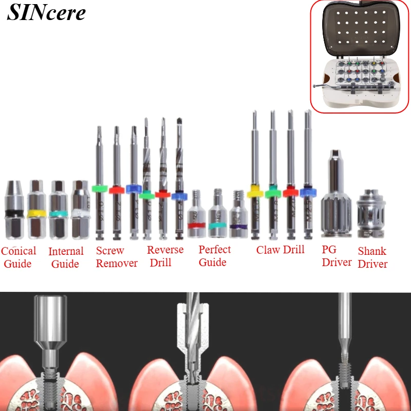 

1Set Dental Implant Abutment Fractured Screw Removal Kit Root Screw Root Post for Repairing Broken Screws Remover Broken Kit
