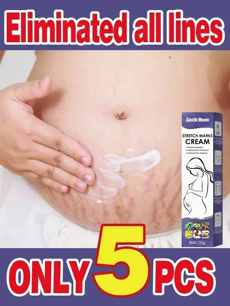 

Effective Stretch Marks Permanent Removal Cream Eliminate Body Belly Stretch Marks For Tunnels