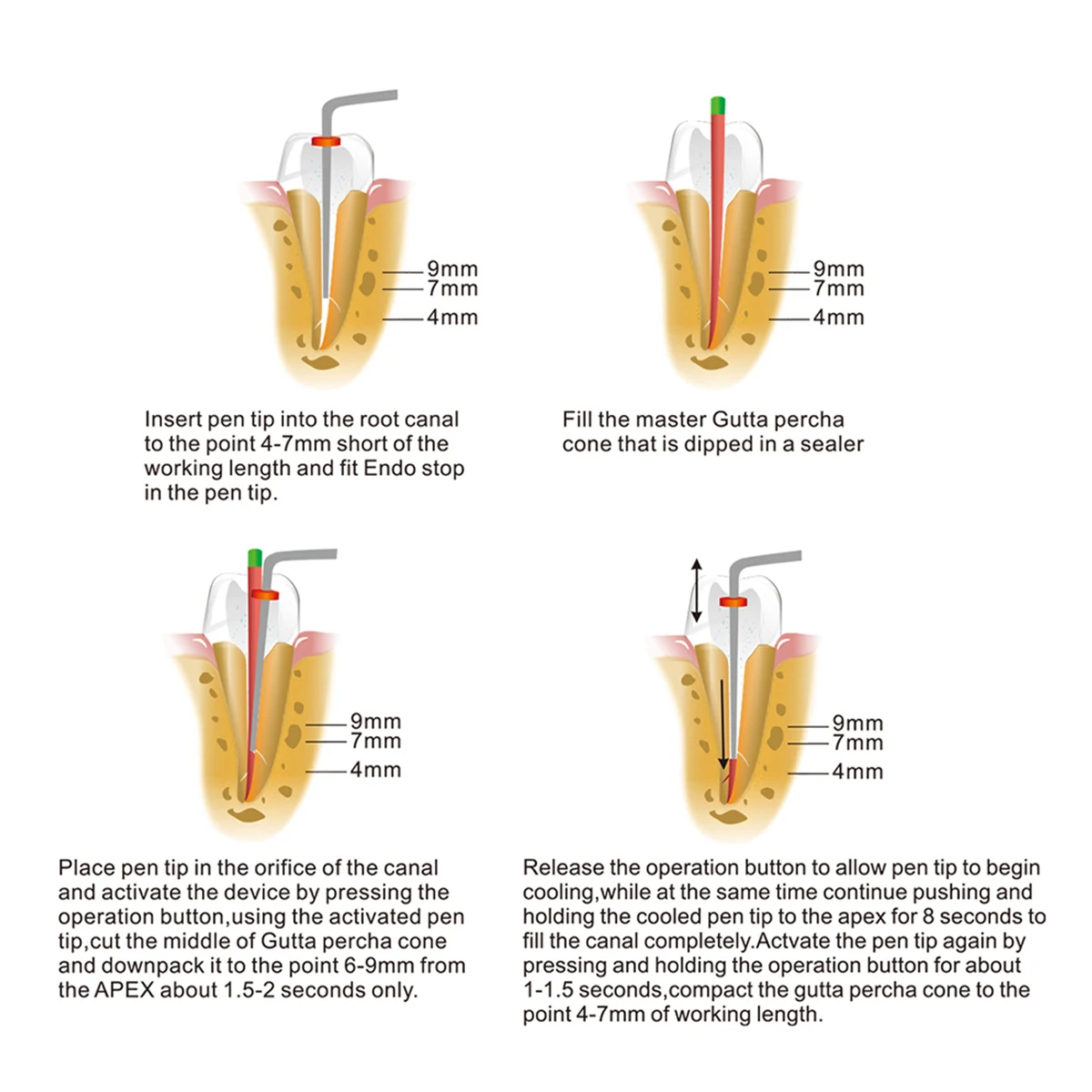 AZDENT-Sistema de obturación de gutapercha Dental inalámbrico, pluma calentada Endo, 2 puntas, laboratorio, 3 segundos, calentamiento rápido,