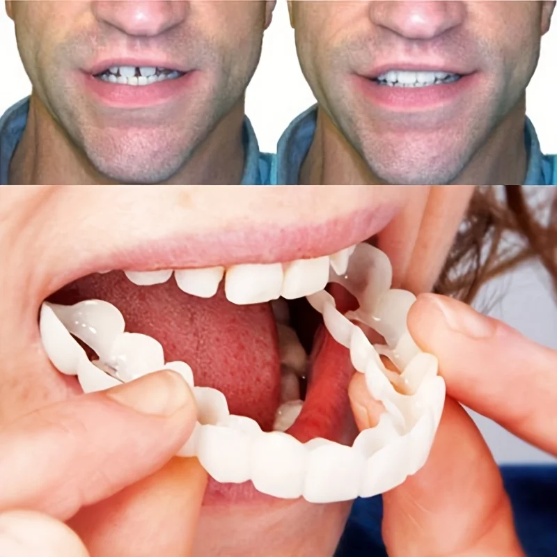 

Snap-On Temporary Teeth Veneers Glue-Free Whitening Comfortable Easy Fit for Daily Life Party Social Occasions ck848