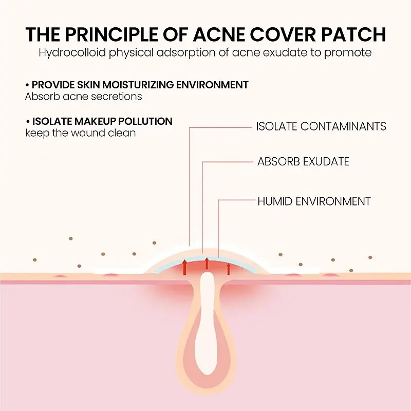 Parche reparador para acné, cuidado de la piel Facial, desvanecimiento de imperfecciones, marcas de espinillas, cubierta cerrada para imperfecciones de acné, parche reparador de espinillas y acné