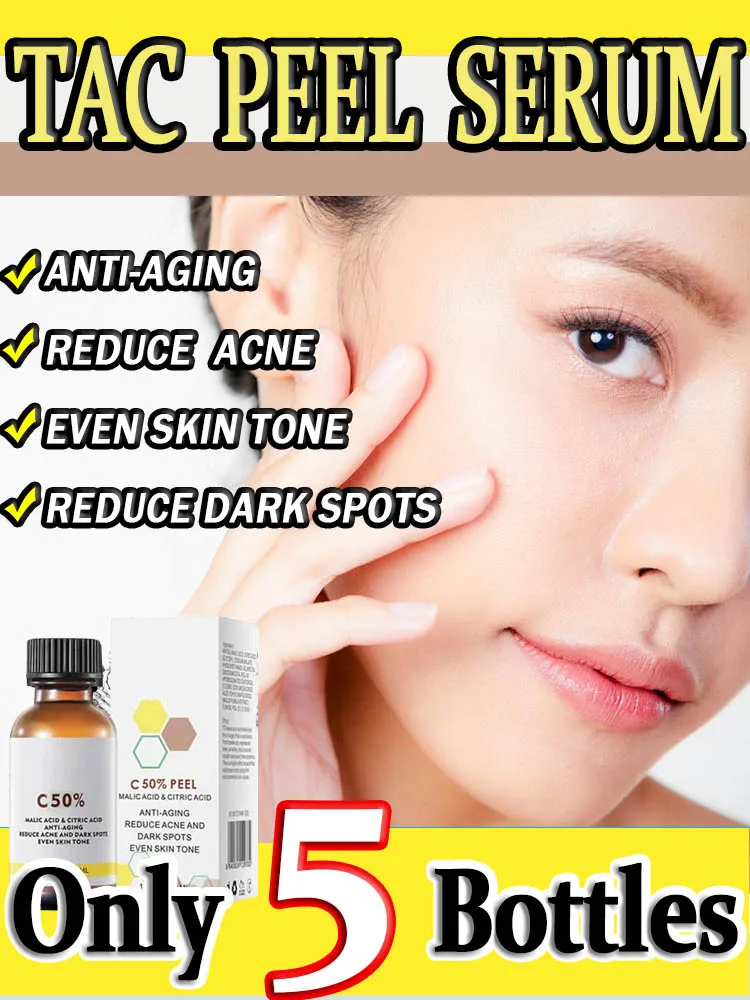 Face Care Exfoliating Yellow Peeling Oil Chemical Peel  Bleaching Dark Skin Remove Spots Arm Knee Legs Melanin Pigmentation