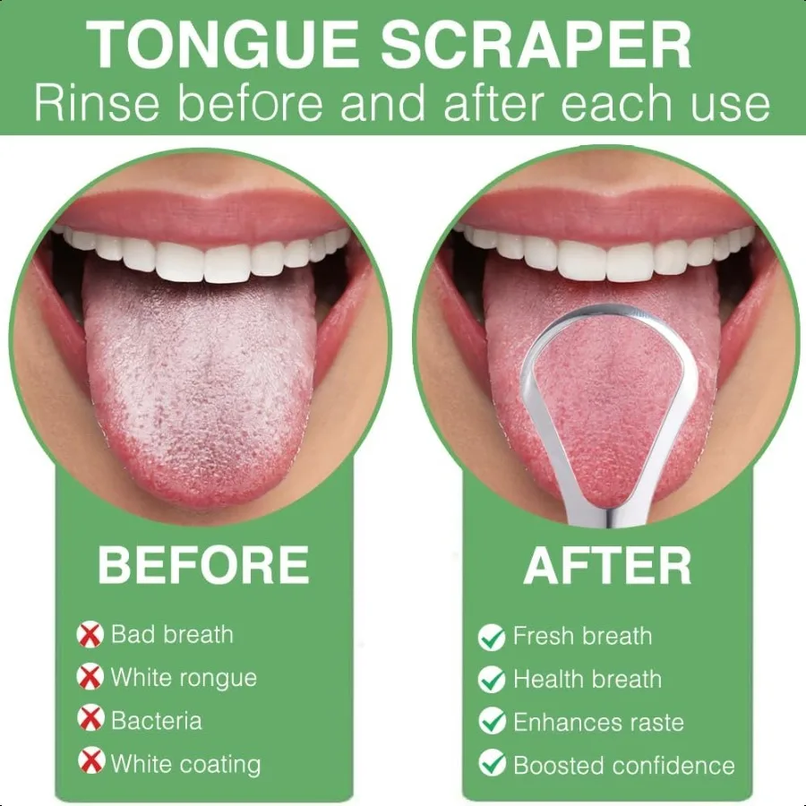 كاشطات فرش اللسان منظفات مكشطة اللسان 2 حزمة منظف اللسان واسع الرأس مع شكل ملعقة يقلل من رائحة الفم الكريهة من الفولاذ المقاوم للصدأ