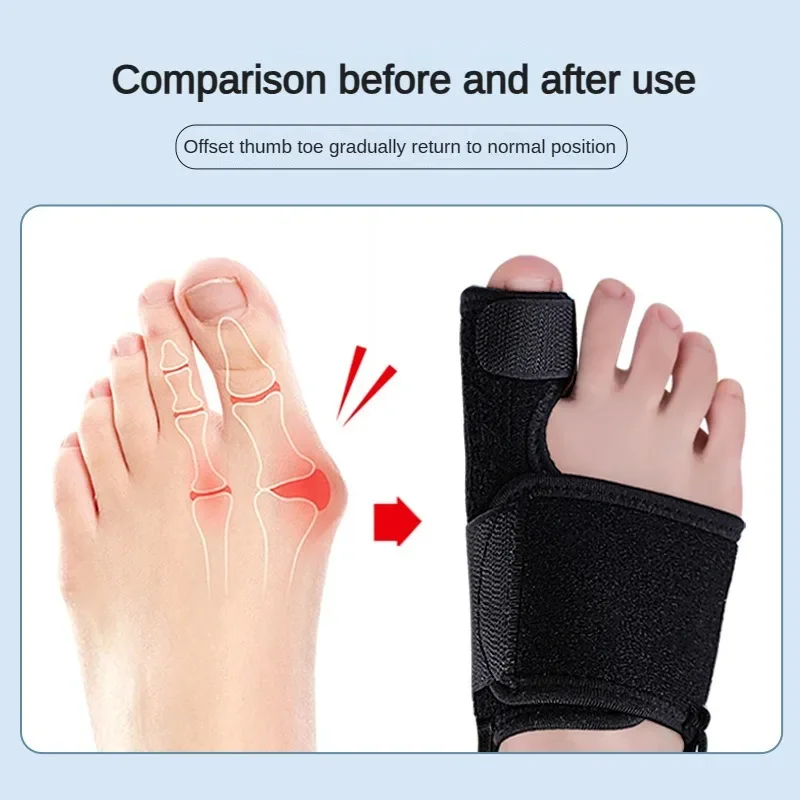 1PCS Toe Corrector Orthotics Bone Thumb Adjuster Hammer Protector Soft Pedicure Sock Bunion Straightener Foot Care Tools