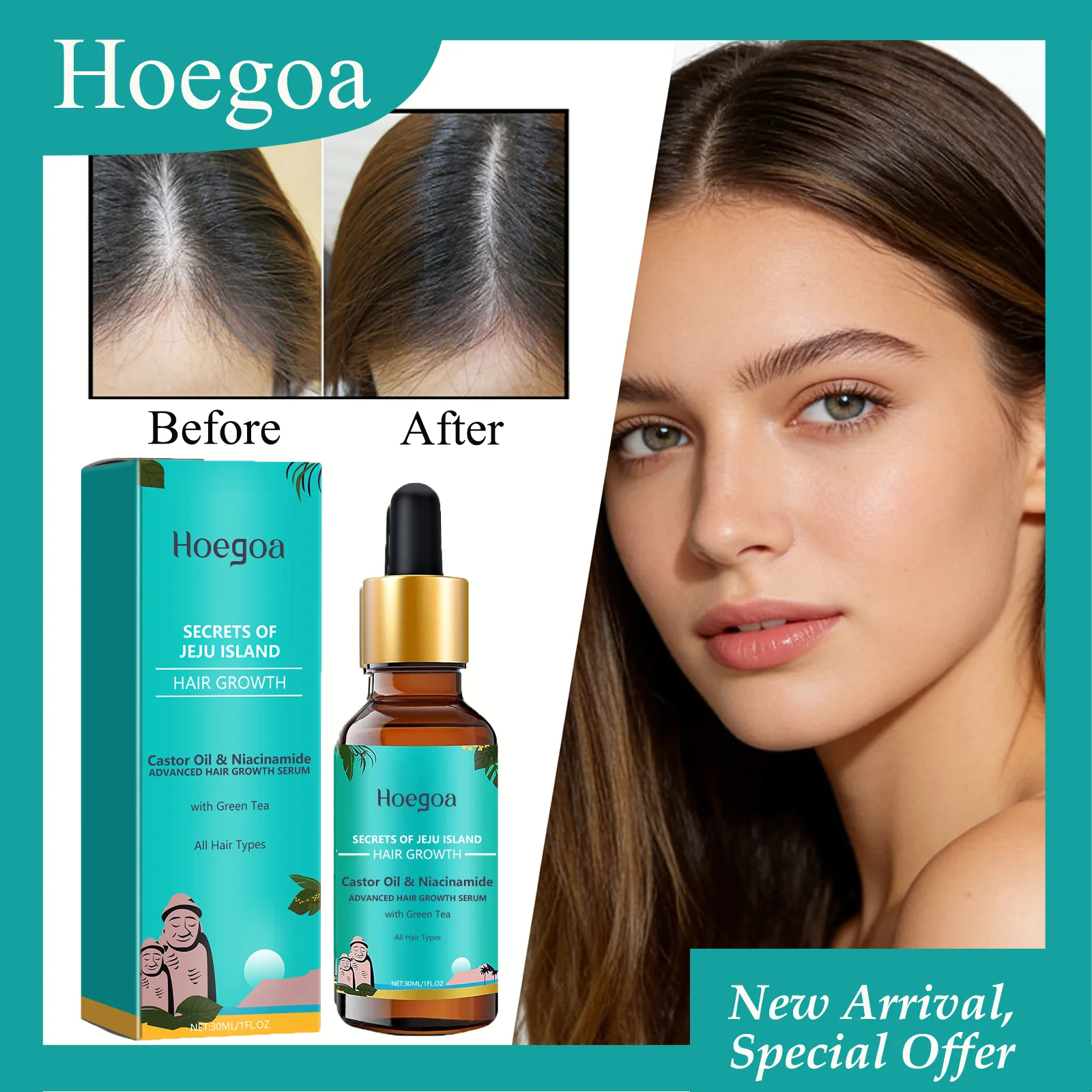 HOEGOA 30mL Advanced Hair Growth Serum Promotes Hair Growth Makes Hair Stronger Relieves Hair Loss Advanced Hair Growth Serum