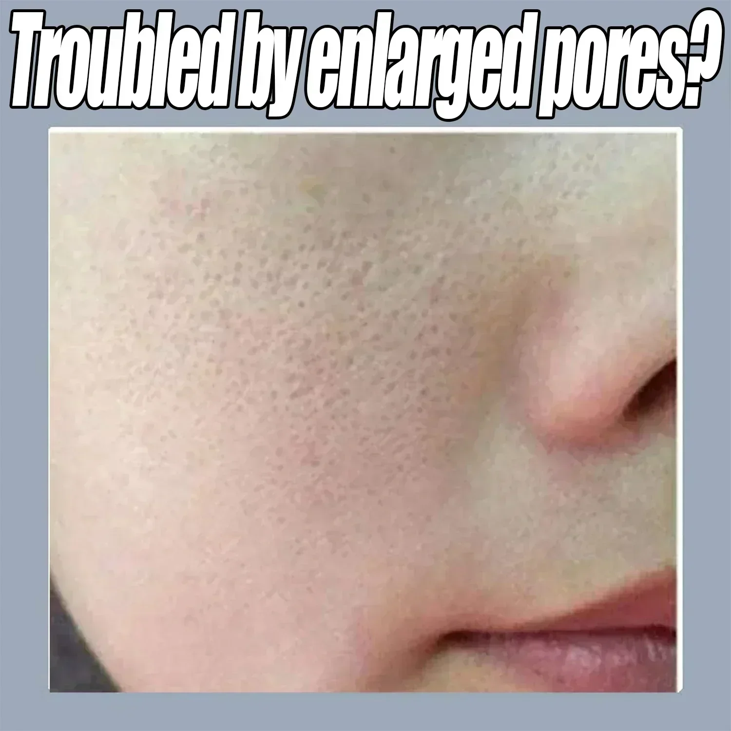 การขจัดรูขุมขนขนาดใหญ่บนใบหน้า Pore Rinning Resurfacing เซรั่มหดตัวรูขุมขนอันทรงพลังเพื่อการกระชับ