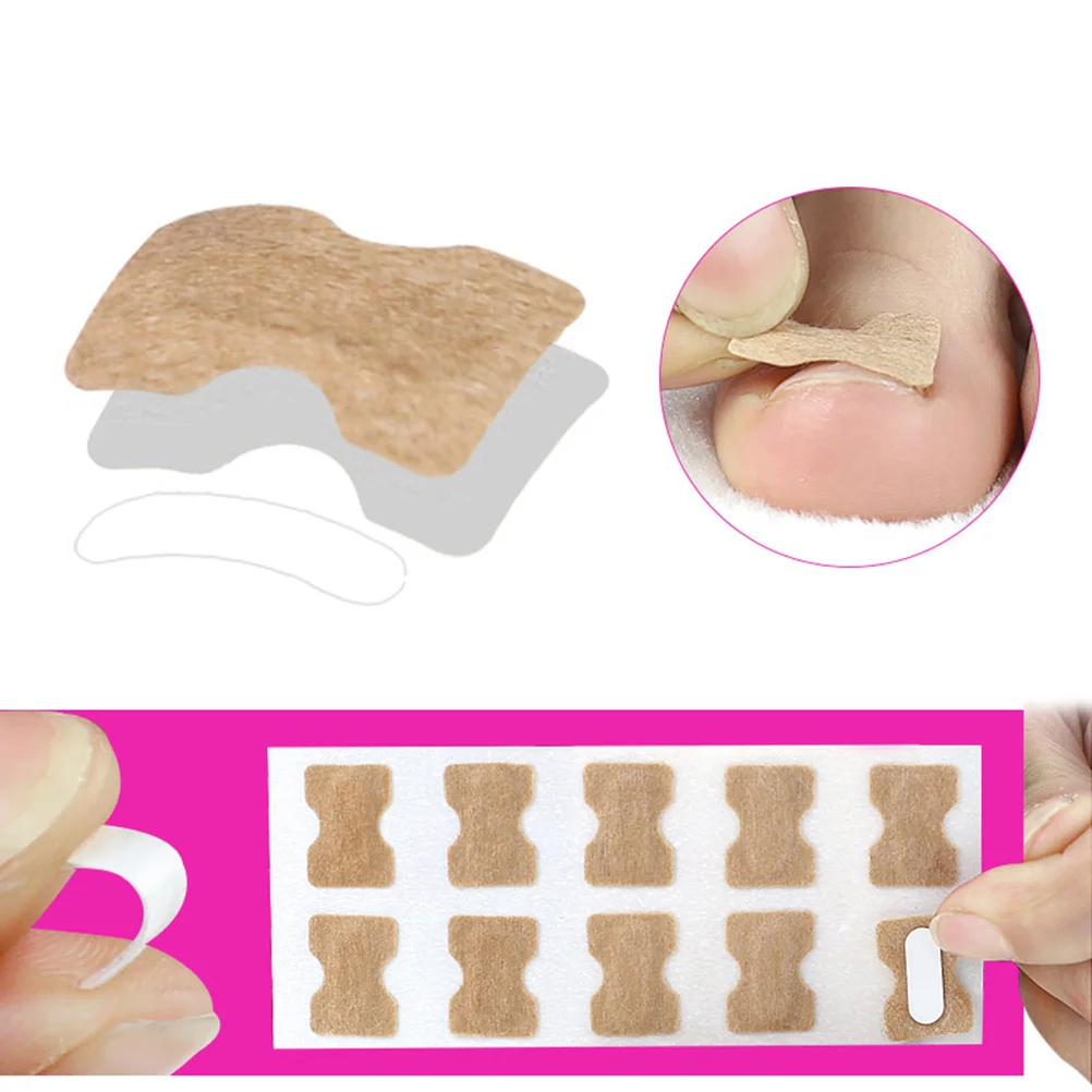 2 แผ่นเครื่องมือแต่งเล็บเทปกาว Pedicure สําหรับฟุตเล็บชุดเท้า Patch Corrector สติกเกอร์