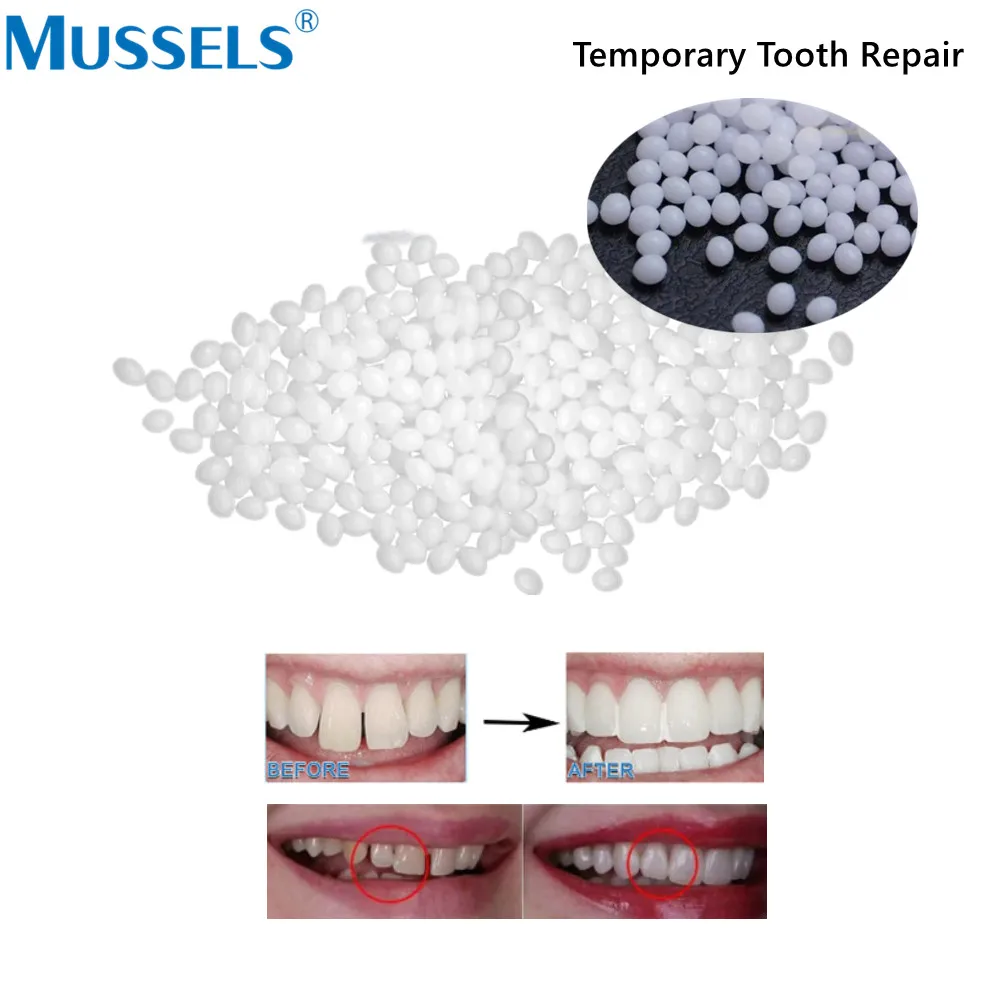 Temporary Crown Resin Tooth Veneers Repair Dental Anterior Front Molar Posterior False Teeth Gaps Filling Material Oral Care Kit