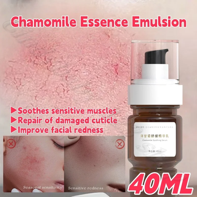 

Chamomile essence lotion soothes sensitive muscles to repair damaged stratum corneum to improve facial redness 40ml