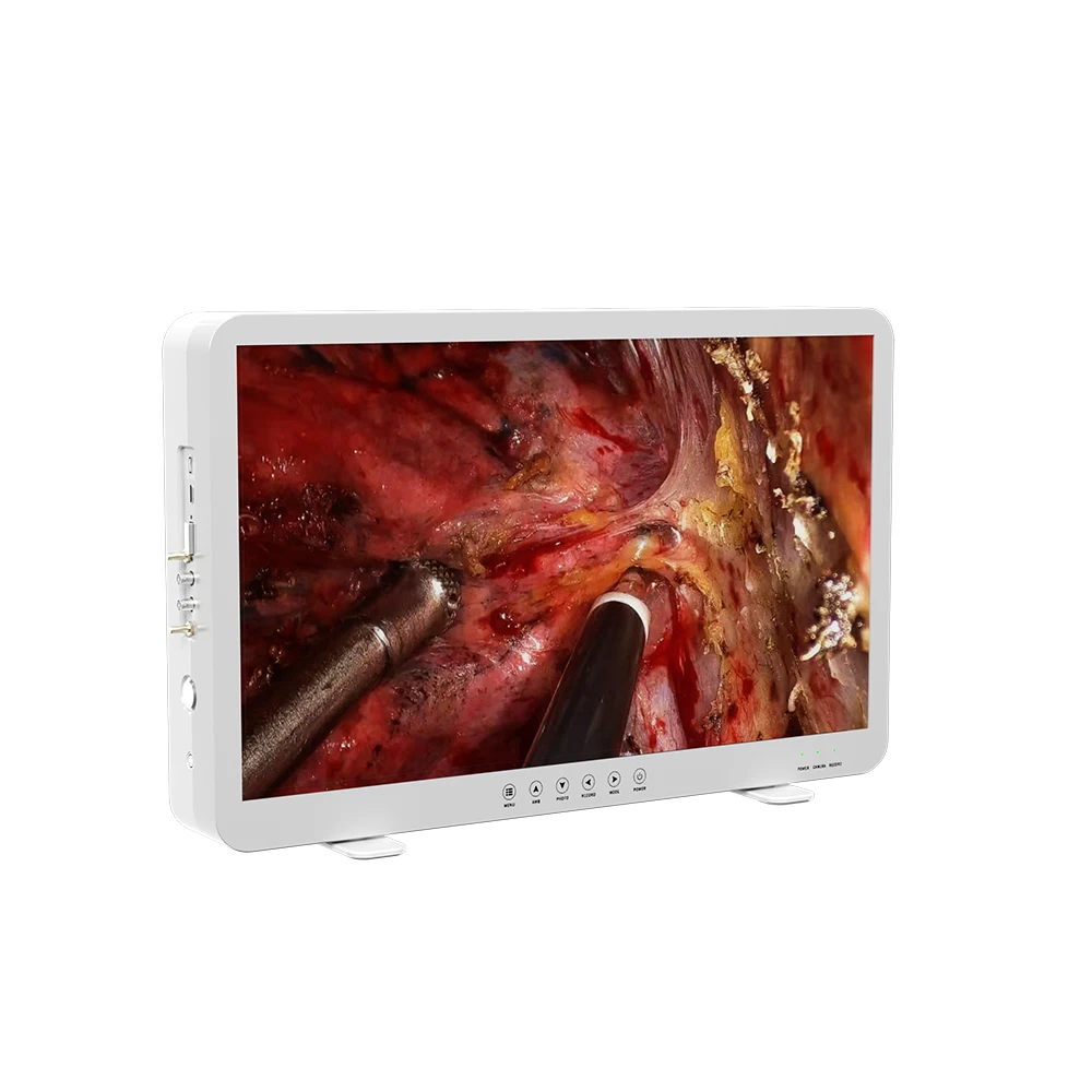 all in one telepack medical endoscope camera video endoscopy camera with cold light source