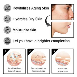 Bir nemlendirici yüz, hyaluronik, krem, nemlendirici, salyangoz anti-kırışıklık, aging, nemlendirici, gözenekleri küçültmek, beyazlatma, smooth skin Yüzdeki kremin 6 büyük satışı-no. 4