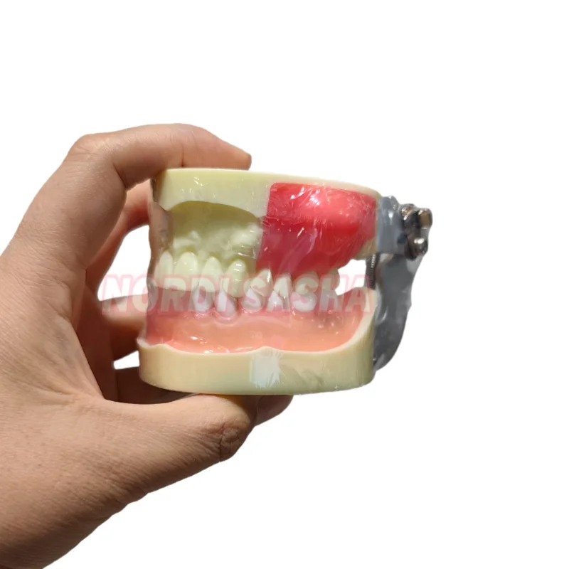 

1Pcs Dental Abscess Model Abscess Incision Practice Display Teaching Teeth Model Pus Removal Practice Model