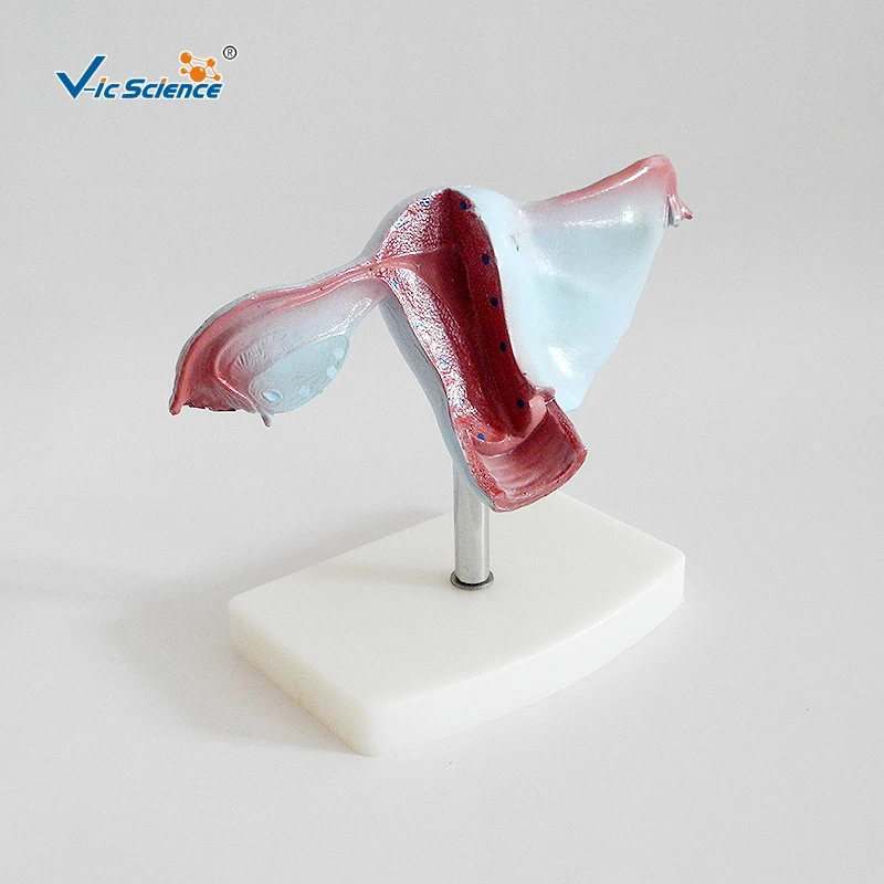 Natural Uterus Model Anatomical Model of Uterine Structure