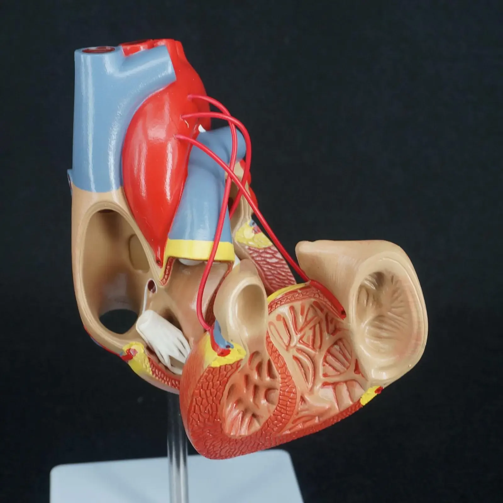 Scientific Heart with Bypass Life Size Anatomical Model Anatomy Teaching Resources