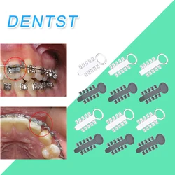Orthodontic Dental Rotation Wedges Lingual For Archwire Brackets Braces Use Orthodontic Dentist Ligature Rotary Torsion Pad 2pcs