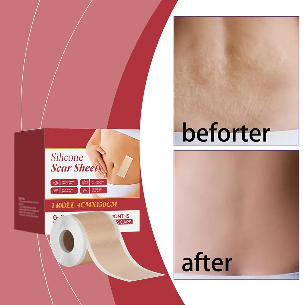 

1-рулонный силиконовый гель, невидимый ремонтный патч, самоклеящаяся расширенная противоизносная нашивка, водонепроницаемая нашивка для шрамов, инструменты для макияжа