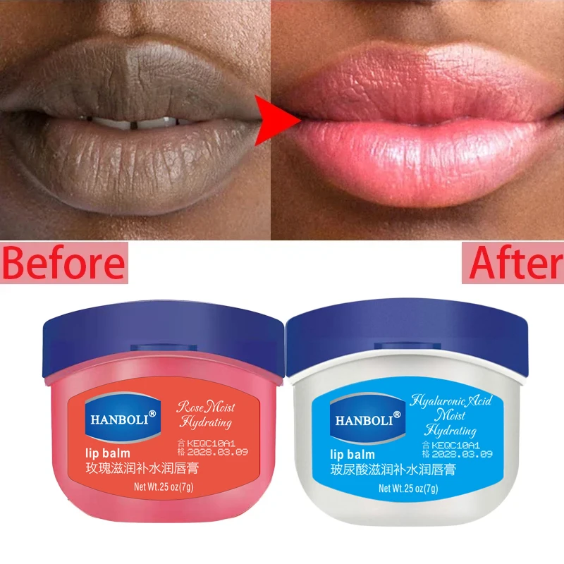 

Remove Dark Lip Balm Lightening Melanin Mask Gloss Oil Exfoliating Clean Moisturizer Korean Care Products Makeup Beauty Health