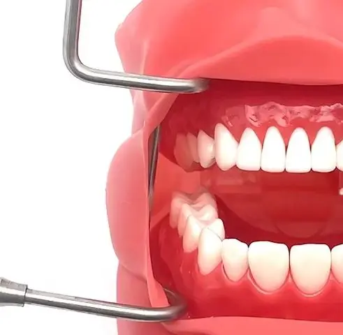 

1pcs Dental Mouth Expand Lip Retractor Intraoral Cheek Stainless Steel Retractor Dentistry Material Tool