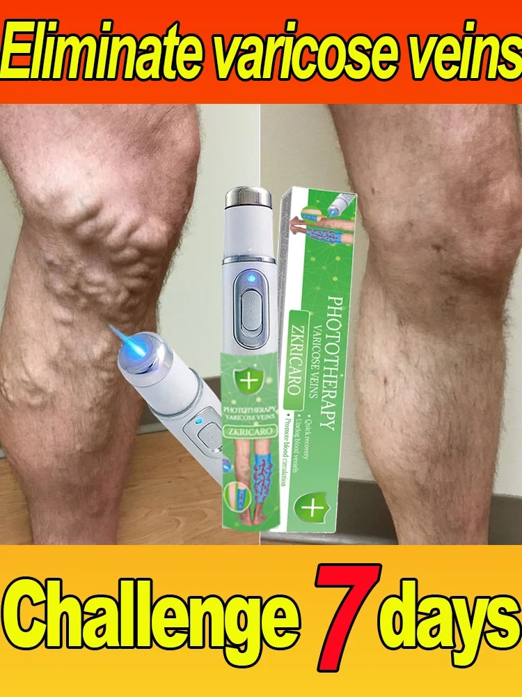 

Powerful Laser Therapy for Moderate Varicose Veins，Clear varicose veins，Vasculitis，Repair varicose veins in 7 days