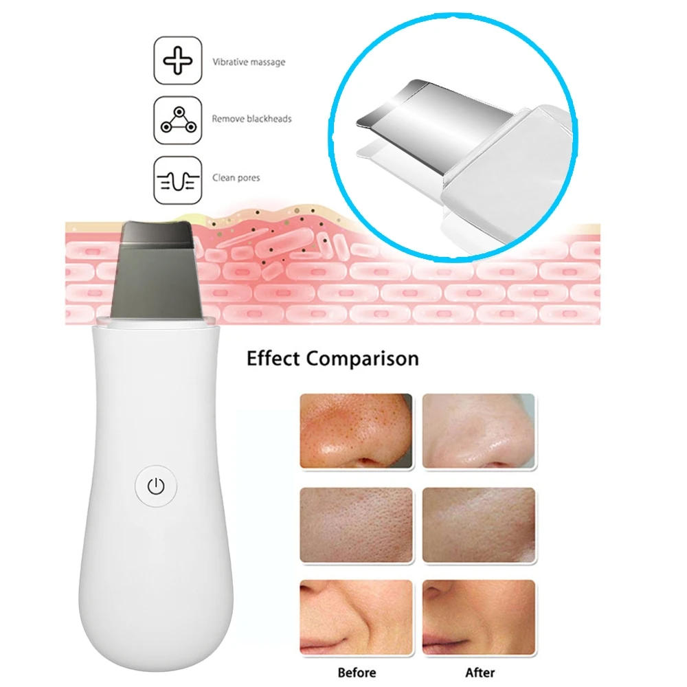 초음파 피부 스크러버 고주파 진동 얼굴 마사지기 딥 클린 얼굴 블랙헤드 모공 제거 얼굴 스크럽 기기