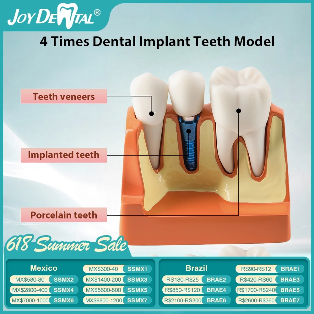 

Dental 4 Times Teeth Model Implant Analysis Crown Bridge Demonstration Removable Model Dentisty Study Training Teaching Model