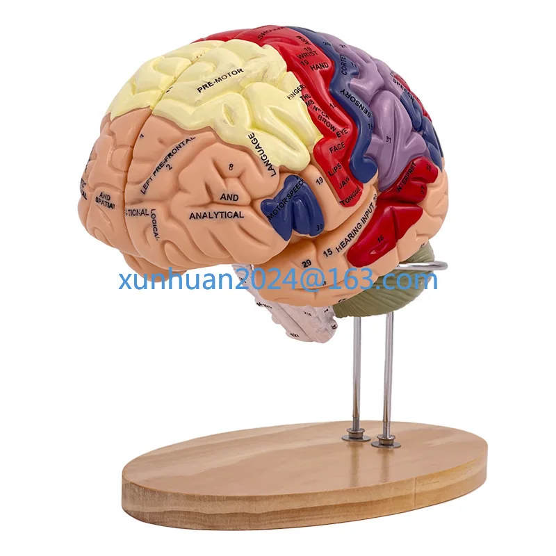 2x magnification, 4-component brain accessory cerebral artery model, cerebrovascular model, neurological brain anatomical model