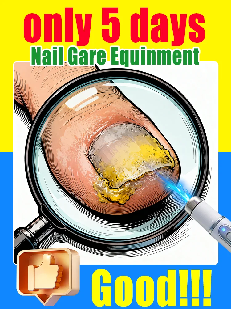 The fifth generation of champagne-colored nail laser penʜᴇʟᴘs ʏᴏᴜ sᴀʏ ɢᴏᴏᴅʙʏᴇ ᴛᴏ ᴏɴʏᴄʜᴏᴍʏᴄᴏsɪs. Tᴇᴄʜɴᴏʟᴏɢʏ ᴄʜᴀɴɢᴇs ʏᴏᴜʀ ʟɪharᴇ。