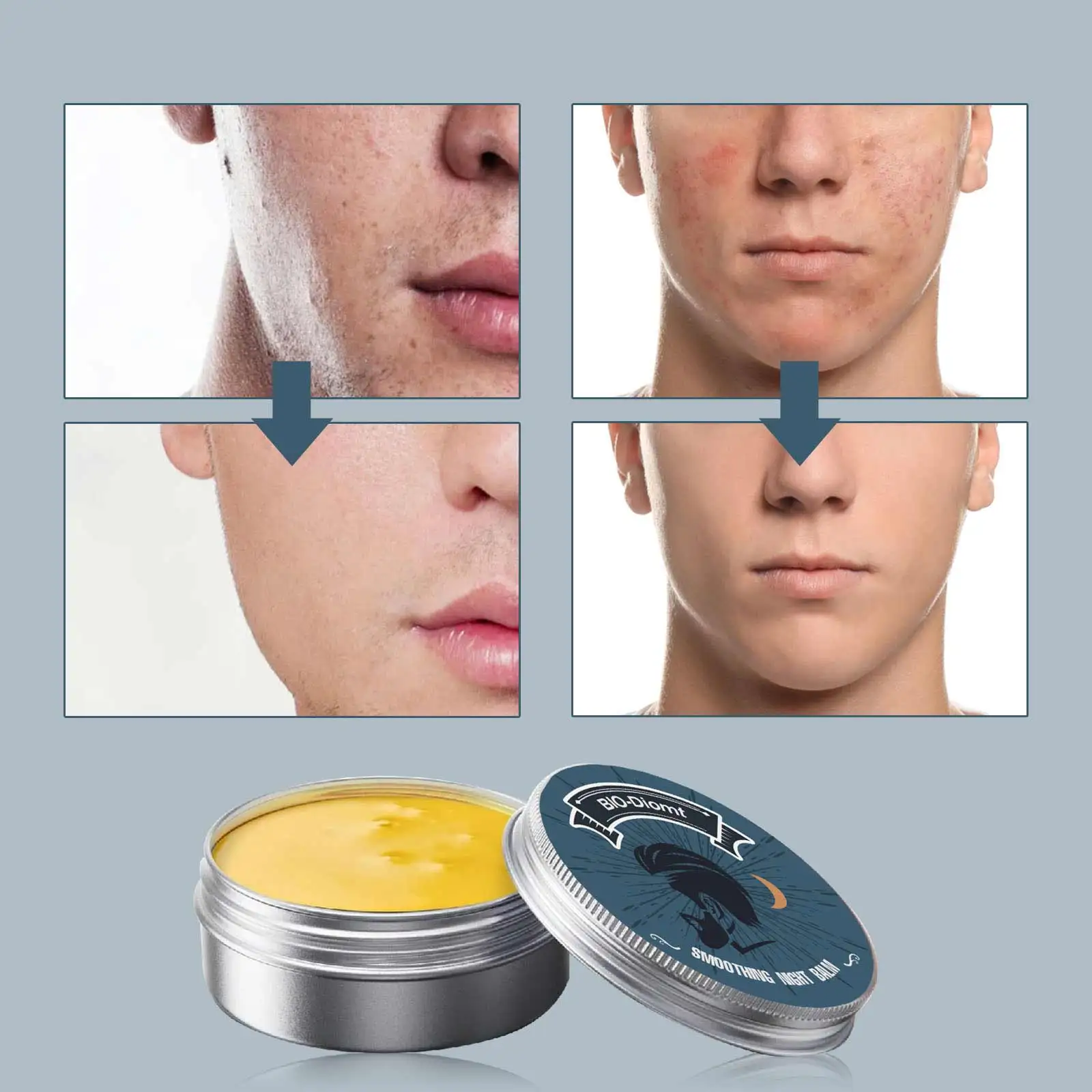 balsamo-noturno-suavizante-masculino-50ml-creme-hidratante-para-cuidados-com-a-acne-reducao-de-vermelhidao-controle-de-oleo-para-todos-os-tipos-de-pele-evita-fuga