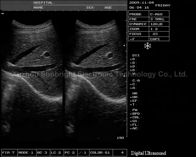 SUN-806H Notebook b ultrasound machine color clear images human pregnancy test ultrasound