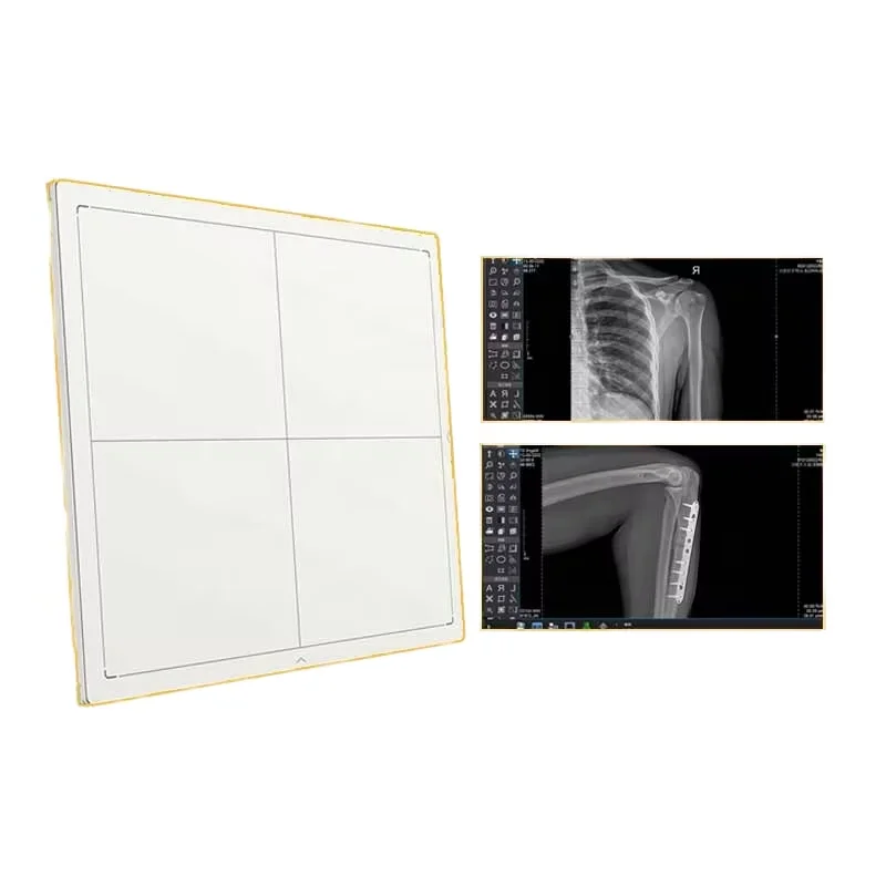 X Ray DR Flat Panel Detector for Hospital Medical Diagnostic Radiography