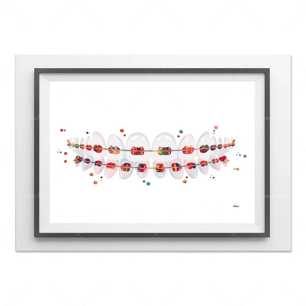 Dental Art Print Braces Aquarelle Dents Anatomie Art Poster Stomatology Dentist Clinic Wall Art Teeth Braces Print Dental Care O