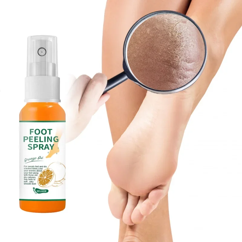 Espray Exfoliante para el cuidado de los pies, espray Exfoliante para talón, codo y rodilla, antisecado, eliminación de grietas, piel muerta, callos, reparación de manos y pies