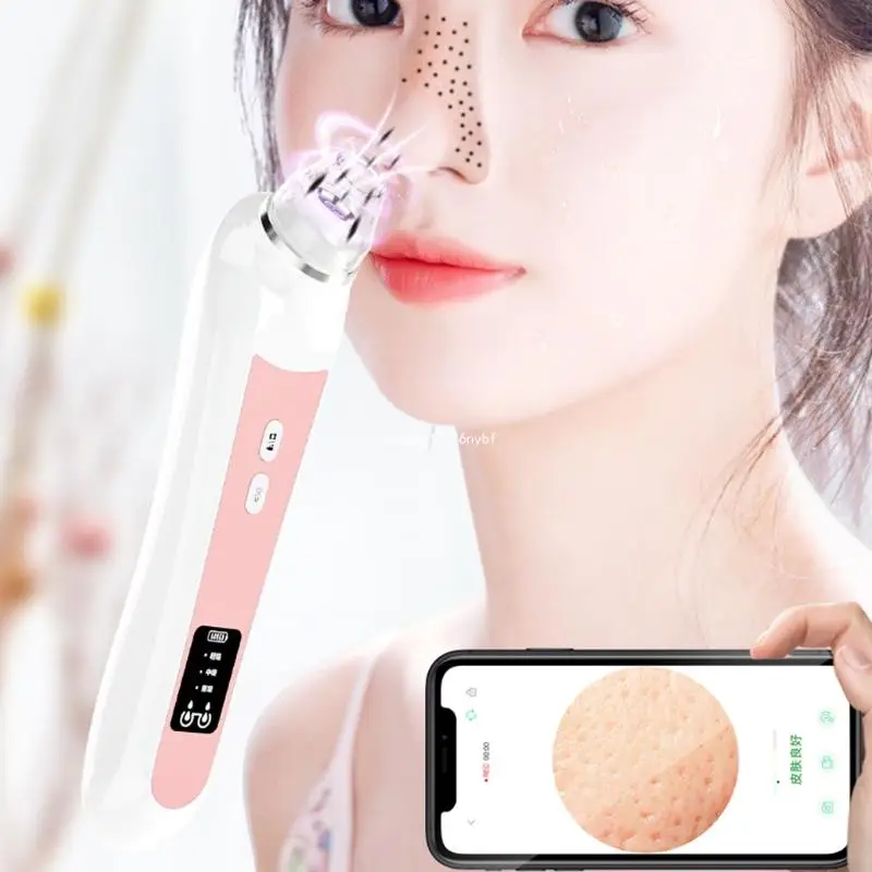 Usuwająca zaskórniki Odkurzanie do czyszczenia twarzy Czarne kropki Ssanie Złuszczające piękno Dropship