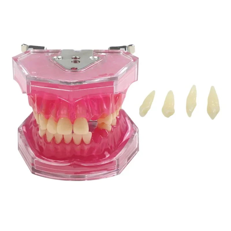 

Dental Teeth Model Dental Extraction Model with Removable Teeth Teaching Model Dental Materials