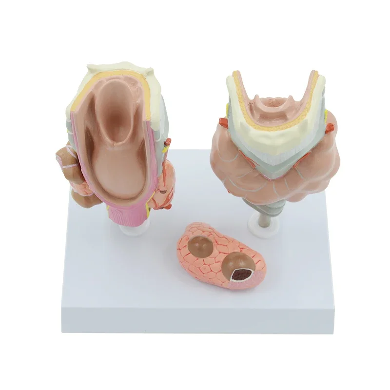 Throat Thyroid Model Detachable Pathology Throat Anatomy Model , Endocrine System Education Model
