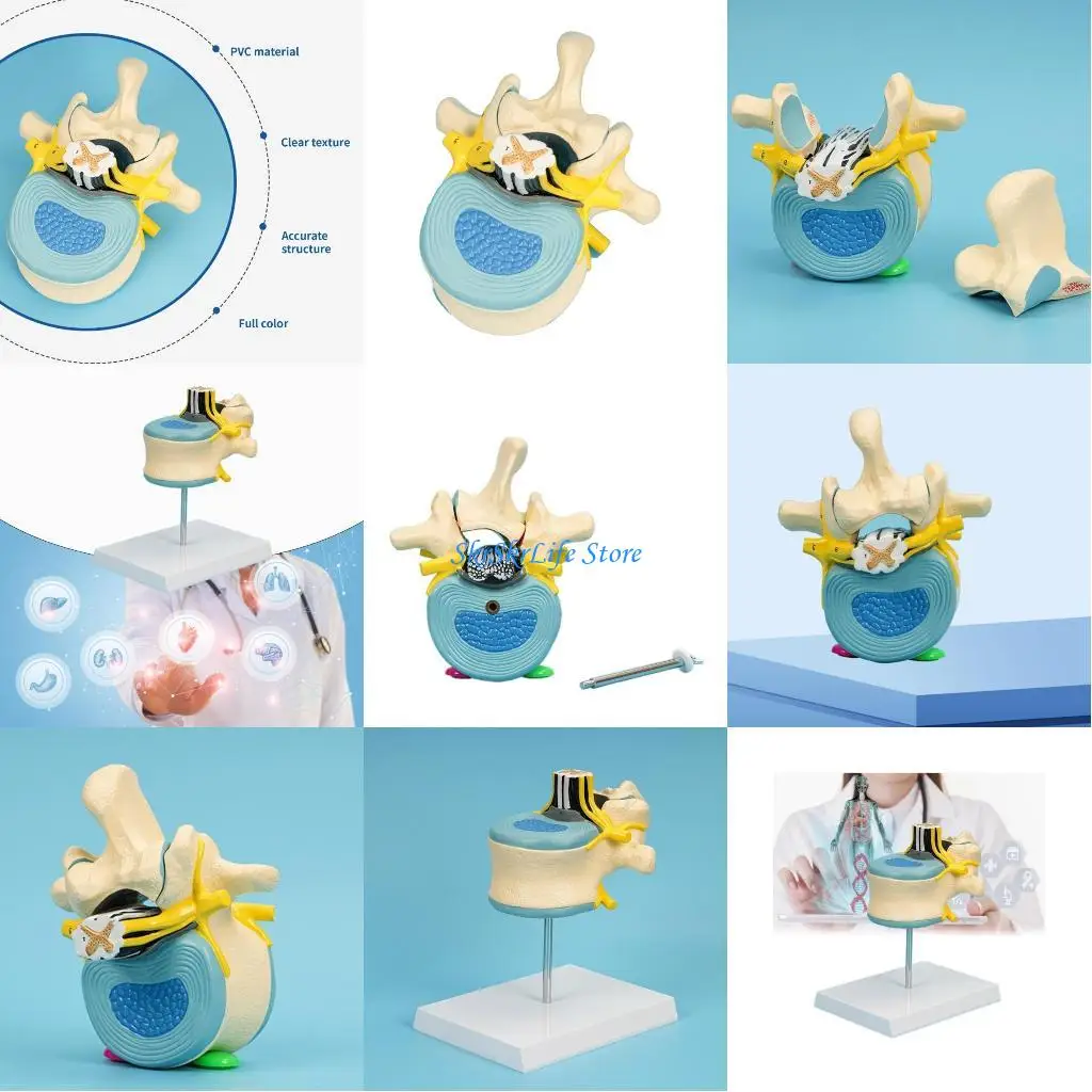 

E65E Human Lumbar Vertebra Anatomy Model Teaching Aids Human Lumbar Spinal Cord Model