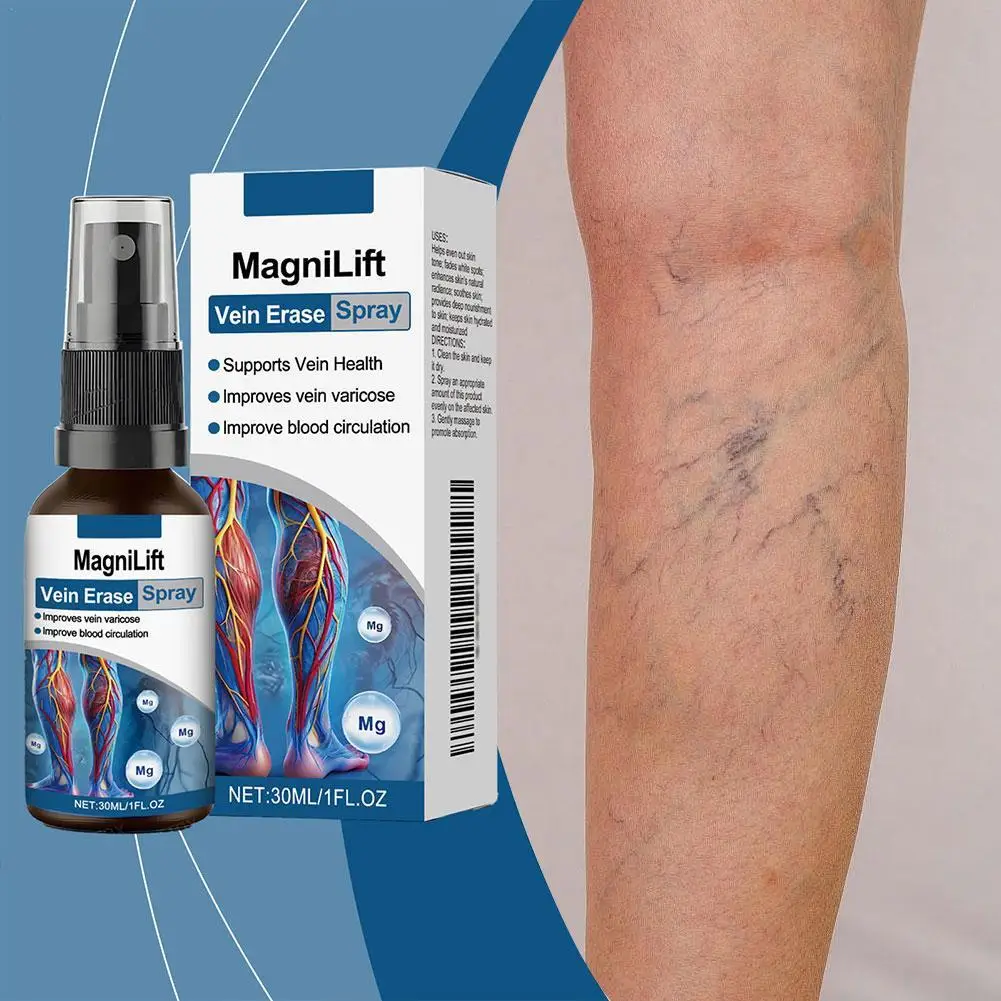 

30ml Varicose Vein Soothing Solution Repair Vasculitis Phlebitis Angiitis Removal Promote Blood Circulation Relief Spray
